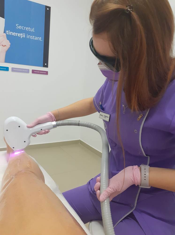 Epilare definitivă laser – un pas important pentru fericirea picioarelor mele